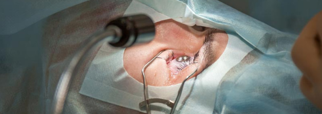 Хирургия глаз